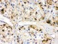 Anti-Fetuin A Antibody